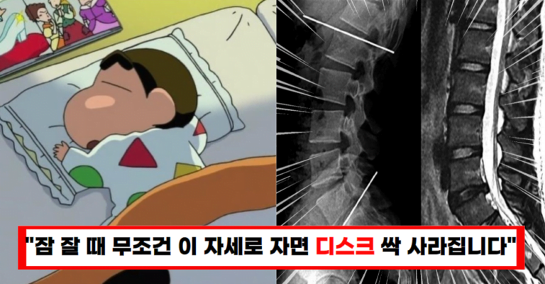 “잠은 이렇게 자세요” 디스크, 불면증 잡아주고 꿀잠 자게 하는 최고의 수면 자세