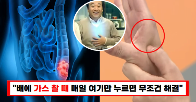 “더 이상 참지 마세요” 복부팽만감 완벽해결 방법 공개(+지압법까지)