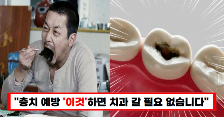 “이것 절대 먹지 마세요”치과의사가 알려주는 치아에 나쁜 음식 5가지(+사후 관리 방법)