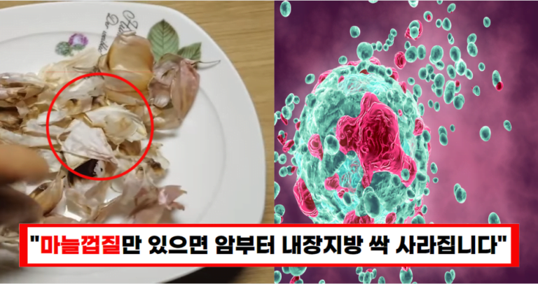 “마늘껍질 절대 버리지 마세요” 혈관 건강부터 암예방에 탁월합니다