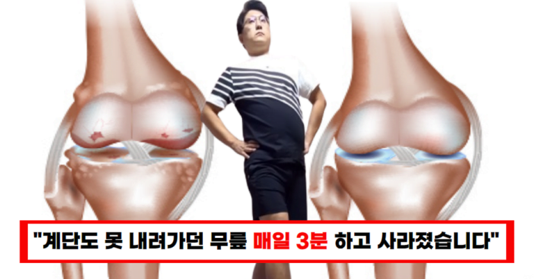 “주사로도 해결되지 않던 무릎 통증” ‘이것’ 매일 3분하고 뛰어 다닙니다!