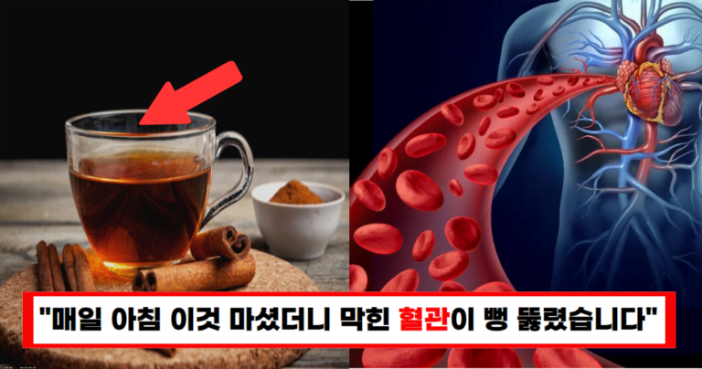 “물 대신 제발 이것 드세요” 배변과 콜레스테롤 혈당의 악순환이 끊어집니다!