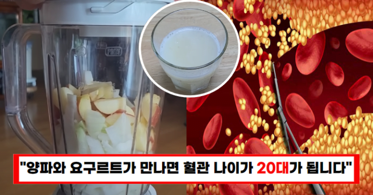 “양파는 이렇게 드세요 꽉찬숙변 쏟아지고 기름으로 찌든 혈관 깨끗이 뚫어줍니다!”