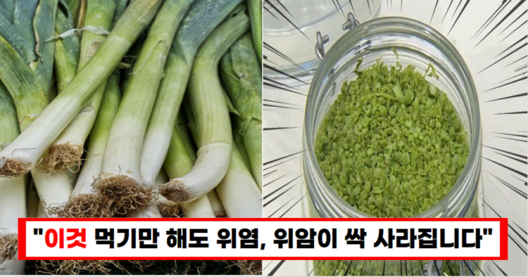 “대파와 천일염만 있으면 말기 위암도 얼씬 못합니다”