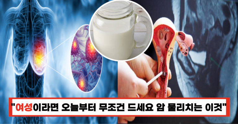 “여성분들, 오늘부터 이것만은 꼭! 유방암, 자궁암, 난소암을 물리치는 비법 공개!”
